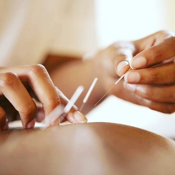 Ommmango Wellness - Acupuncture needles are gentle hair thin needles! They are painless! - Massage Therapy Near Me - Brooklyn, New York Ommmango Wellness - Acupuncture needles are gentle hair thin needles! They are painless! - Massage Therapy Near Me - Brooklyn, New York