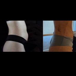 before and after