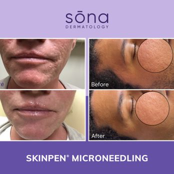Sona MedSpa - Skin Care Near Me - Glen Allen, Virginia