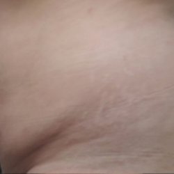 Lotus Spa Body Contour - Before lotus spa treatments, diet and exercise, and me at my worst.