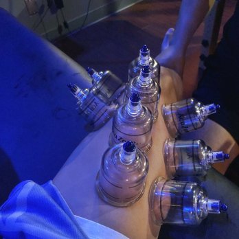 Recovery Lab - Cryotherapy Near Me - La Verne, California Recovery Lab - Cryotherapy Near Me - La Verne, California