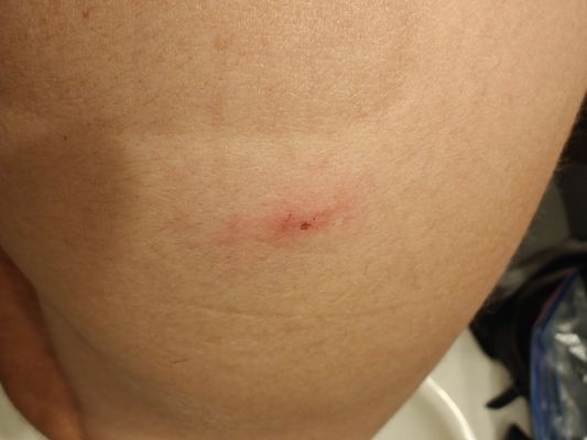 HotelTonight by null