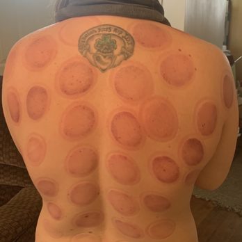 Healthy Mind and Body Acupuncture - Acupuncture Near Me - Lyndhurst, New Jersey