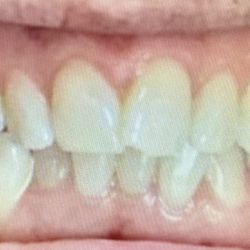 Dentistry of the Ozarks - Before picture
