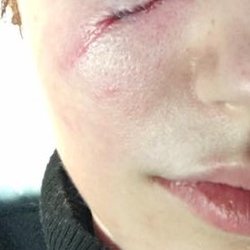 First Care Medical Centers - After Stitches