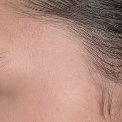 Pariser Dermatology Specialists