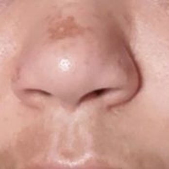 Verve Med Spa & Laser Aesthetics - Medical Spas Near Me - Upland, California