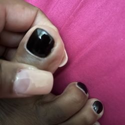 Thumb and big toe with the cuts.
