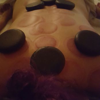 24th Massage - Hot stones after cupping feel wonderful. - Massage Near Me - Bakersfield, California