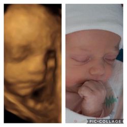 Baby Bumps - My girl!