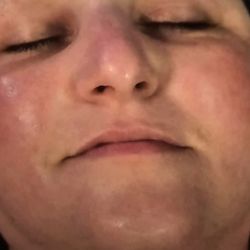 Fly Girls Esthetics and Nails - Happy Glowing Skin after Glow Baby Facial