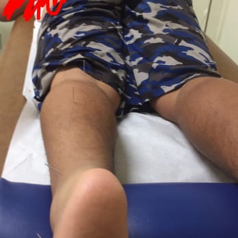 Chuy Acupuncture - To add to my review - Acupuncture Near Me - El Monte, California
