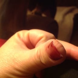 Left thumb "redo" two days later.  1/12/2015