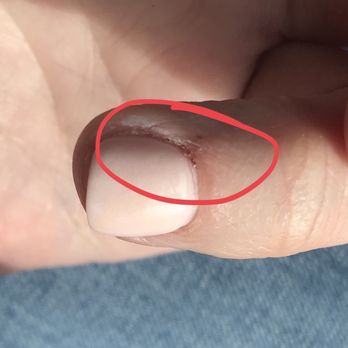 Modern Nails Boutique Salon - Dried blood at cuticle from cuticle trim. - Nail Salons Near Me - Charlotte, North Carolina