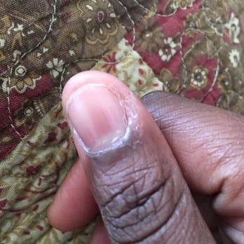 Jane's Nails - Fingers look disgusting - Nail Salons Near Me - Farmingdale, New York Jane's Nails - Fingers look disgusting - Nail Salons Near Me - Farmingdale, New York