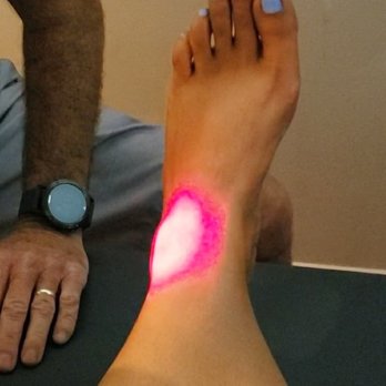 Movement Chiropractic - Cold Laser Therapy - Chiropractors Near Me - Murrieta, California