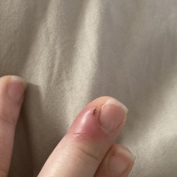 Pageant nails & spa - I went to urgent care to get it sliced open for relief. The pain was insane. - Waxing Near Me - Chandler, Arizona Pageant nails & spa - I went to urgent care to get it sliced open for relief. The pain was insane. - Waxing Near Me - Chandler, Arizona