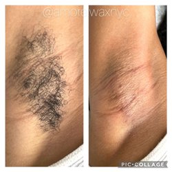 Amore Wax Beauty - Before & After 
Underarm Wax $15