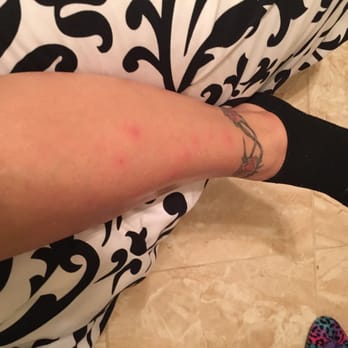 Royal Nail Bar - This is the effect what the pink wax on my one leg!!! - Nail Salons Near Me - Coral Springs, Florida Royal Nail Bar - This is the effect what the pink wax on my one leg!!! - Nail Salons Near Me - Coral Springs, Florida