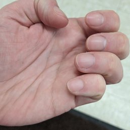 Apologize for my bad habit of biting my nails. I will revisit soon to get them fixed again! Apologize for my bad habit of biting my nails. I will revisit soon to get them fixed again!