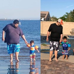 Southern Nevada Bariatrics - This is 7 months after surgery with Surgical Weight Control Center. 200lbs gone!!