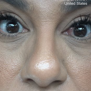 Blinking Eyelash - Eye infection due to the lash technician horrible service!! DO KOT GO HERE - Eyelash Service Near Me - Monterey Park, California Blinking Eyelash - Eye infection due to the lash technician horrible service!! DO KOT GO HERE - Eyelash Service Near Me - Monterey Park, California