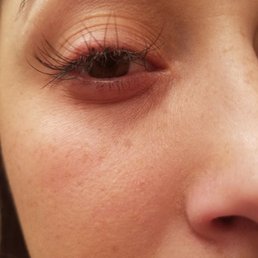 Glue everywhere stuck on my eyelids Glue everywhere stuck on my eyelids
