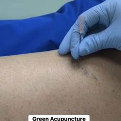 Green Acupuncture and Integrative Medicine