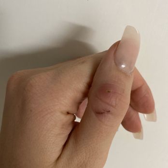 Bella Nails Boutique and Spa - Cut from the drill which got infected. - Nail Salons Near Me - Woodbridge, Ontario Bella Nails Boutique and Spa - Cut from the drill which got infected. - Nail Salons Near Me - Woodbridge, Ontario