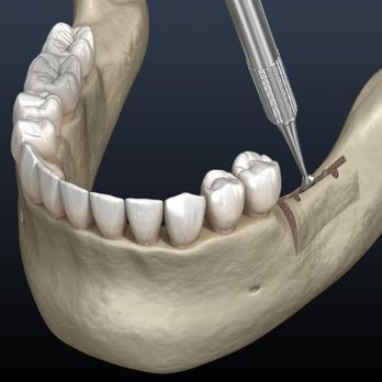 Copper Leaf Dental - General Dentistry Near Me - Hoover, Alabama