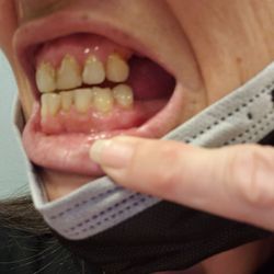 Valley Dental Associates - Completely destroyed