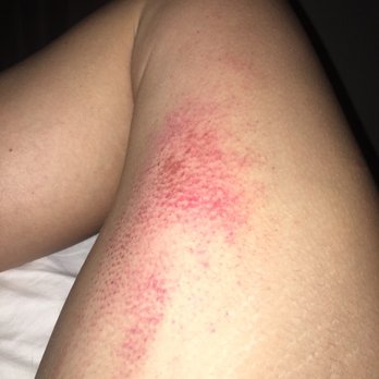 Double Deuce - Wounds after the bull ride! - Dance Clubs Near Me - San Diego, California