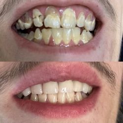 Mayhew Family Dentistry - Huge improvement