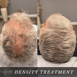 Newport SMP - Density Treatment SMP