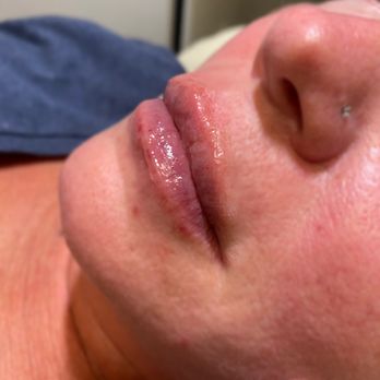 Lush Artistry by Adrianna - After 2ml - Eyelash Service Near Me - Avondale, Arizona Lush Artistry by Adrianna - After 2ml - Eyelash Service Near Me - Avondale, Arizona