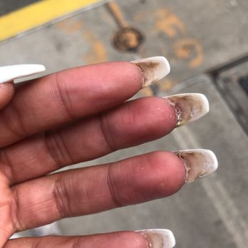 The Nail Story - Haphazardly "drills down" my natural nail that grew on the acrylic. Literally let me walk out of the salon like this. - Nail Salons Near Me - Brooklyn, New York The Nail Story - Haphazardly "drills down" my natural nail that grew on the acrylic. Literally let me walk out of the salon like this. - Nail Salons Near Me - Brooklyn, New York