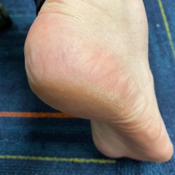 Zen Nails - Dry skin on foot