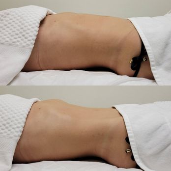Bodyby_emilyg - Brazilian Lymphatic Drainage 1 hr full body - Body Contouring Near Me - Torrance, California Bodyby_emilyg - Brazilian Lymphatic Drainage 1 hr full body - Body Contouring Near Me - Torrance, California