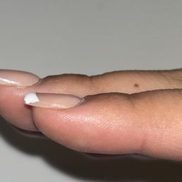 Strait Nail; No Apex