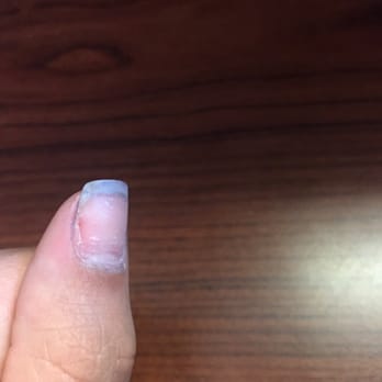 Five Star Nails - Chunk the "stylist" took out of my nail while using the dremel (after prying off my acrylics) - Nail Salons Near Me - Indianapolis, Indiana