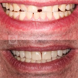 Downingtown Dental Studio - Life changing Smile Makeover