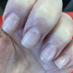 BL Nails - Burnt nails, cut ciuticle, uneven shape