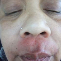 Classic Eyebrow Threading - Still bleeding