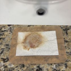 Optimal Bio - Discharge from a pellet placement wound 4 weeks after placement