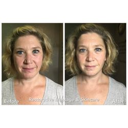 Restorative Massage & Skincare - Before and after of Facial Cupping