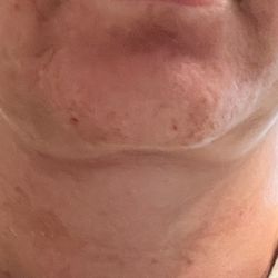 Roseville Facial Plastic Surgery