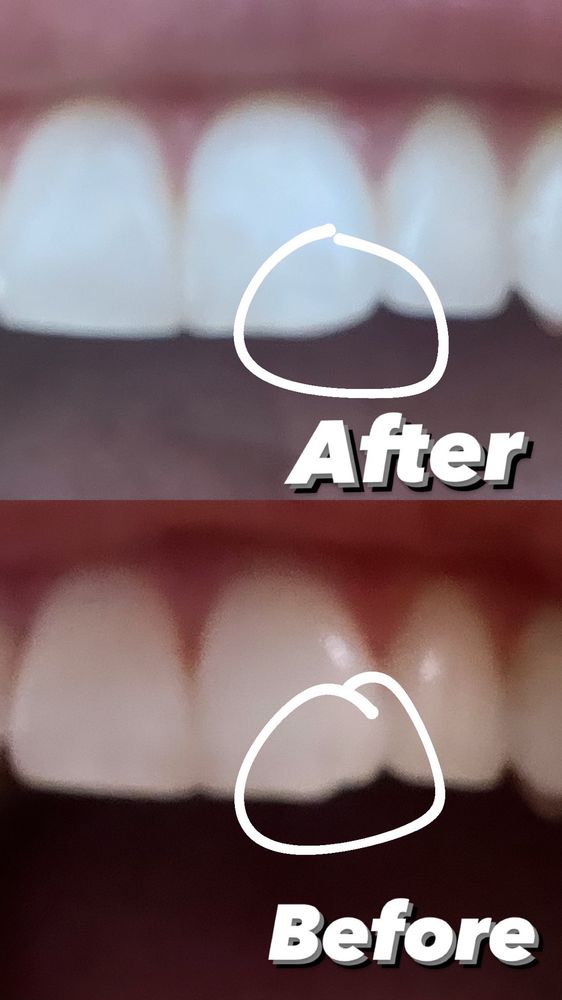 GENTLE DENTAL CHARLESTON 15 Photos & 42 Reviews 3016 W Charleston