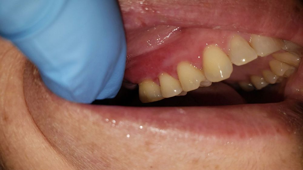 DENTAL DEPOT 16 Photos & 18 Reviews 13828 W Greenway Rd, Surprise, Arizona Cosmetic