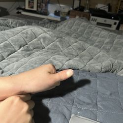 Children's Orthopedics and Sports Medicine - Cherokee - Left thumb. White nail bed