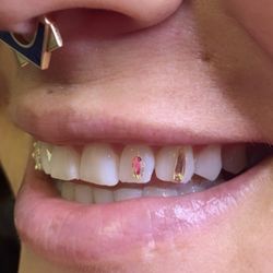 Ke Nani Kino Beauty Bar - Teeth gems and whitening